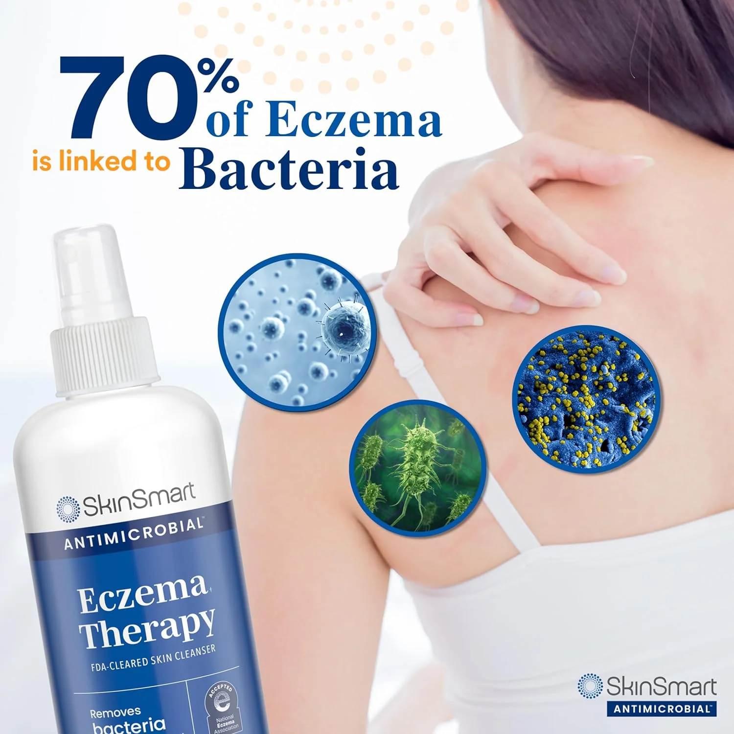 SkinSmart Antimicrobial Eczema Therapy with Hypochlorous Acid - Image 3